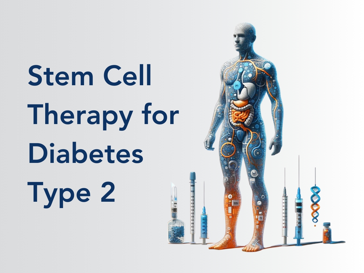 Stem Cell Therapy For Type 2 Diabetes: Complete Guide